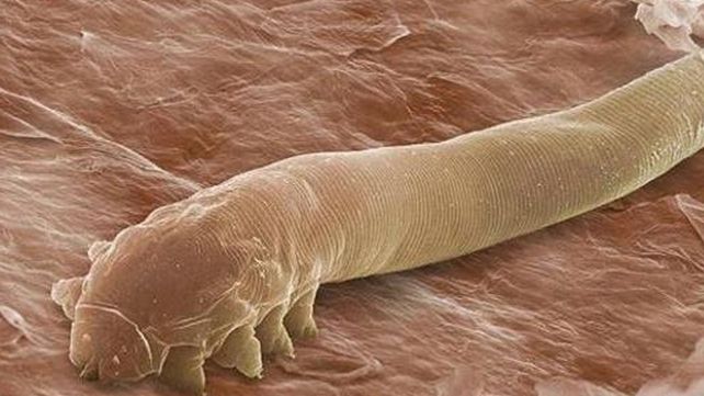 Ni te imaginas en qué parte de tu cuerpo vive esta criatura