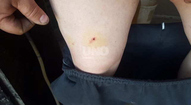 Mató a un caniche y mordió a dos personas