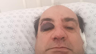 Recibió una golpiza de personas que violaban el aislamiento