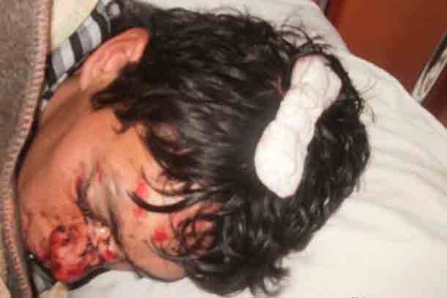 Gualeguaychú: dan una golpiza a un hombre y la policía da su versión sobre el hecho