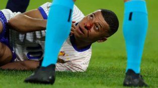 Kylian Mbappé asustó a toda la selección de Francia.