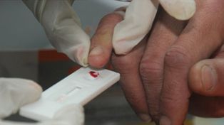 Buscarán generar conciencia en el día de la lucha contra la hepatitis