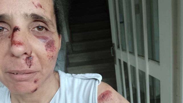 La mujer asaltada en la ciclovía