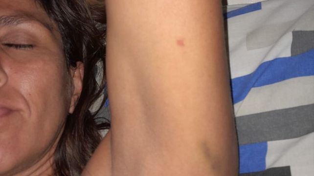 Los golpes fueron constatados en el hospital local y por un perito de asuntos internos de la policía provincial.