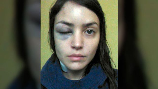 Una joven denunció que un hombre le dio una brutal golpiza en pleno centro porteño