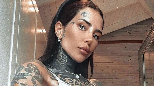 Cande Tinelli decidió borrarse varios de sus tatuajes y mostró el tratamiento