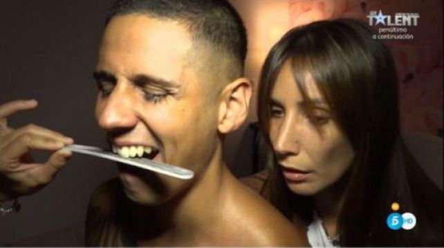 Mal ejemplo. En un reality de la televisión de España un muchacho también se limó los dientes.
