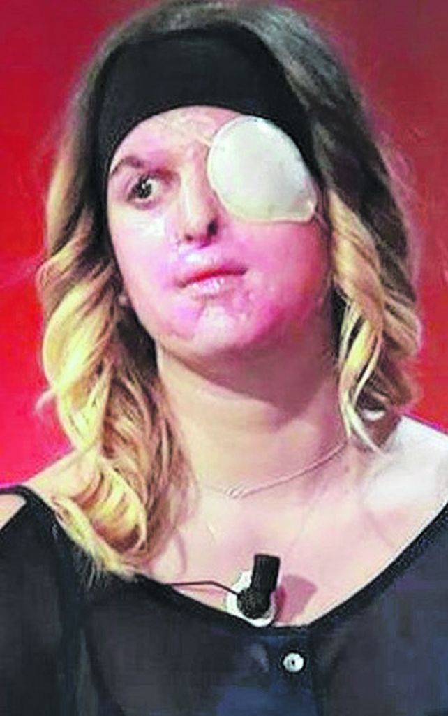 gessica. Así la dejó su ex novio.