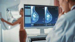 La mamografía. Es el estudio indicado para la detección precoz del cáncer de mama.