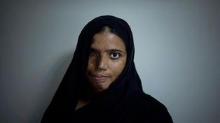Un fot&oacute;grafo espa&ntilde;ol denunci&oacute; con su trabajo la tortura a mujeres pakistan&iacute;es