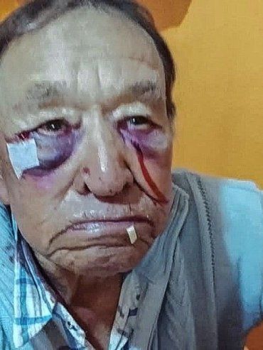 Violento episodio en Domínguez: investigan agresión a un hombre en un establecimiento de salud