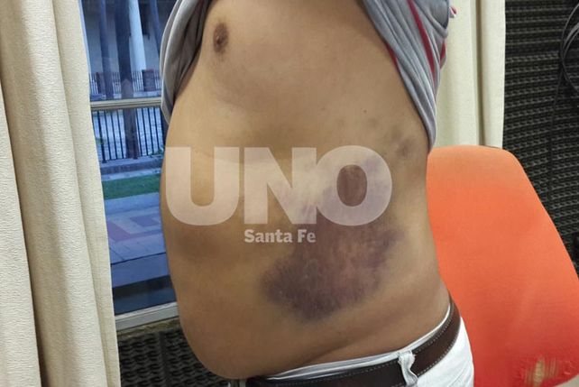 Pastores evangélicos denunciaron que policías les dieron una feroz golpiza