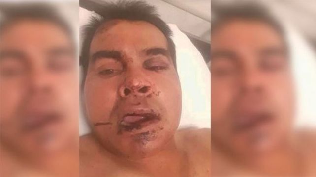 Falsos policías asaltaron a camionero entrerriano