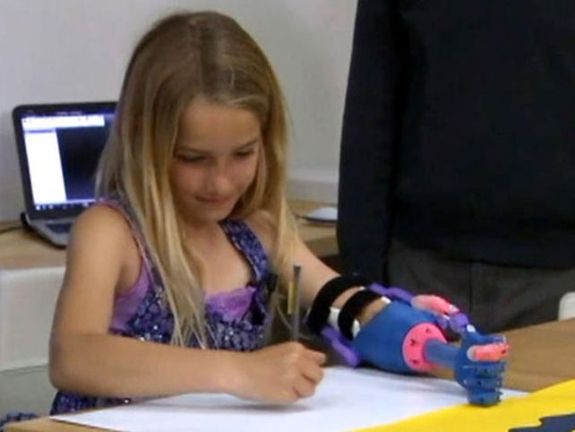 Impresión en 3D permite a niña tener prótesis de mano