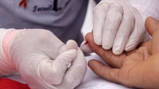 Cómo se hace la prueba rápida de VIH