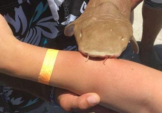 Una mujer fue mordida por un tiburón que no la soltó y tuvo que ir con el pez al hospital