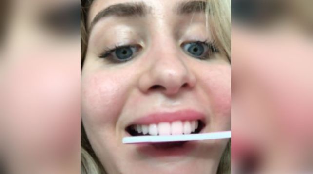 Una locura. Una joven publicó un video en Tik Tok donde se lima los dientes.&nbsp;
