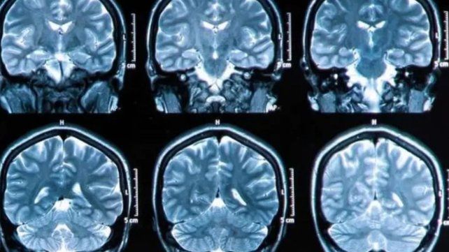 El estudio de investigadores