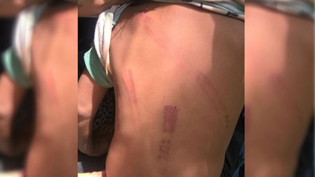 Imputaron a una mujer por torturar a sus hijos de 2, 4 y 6 años