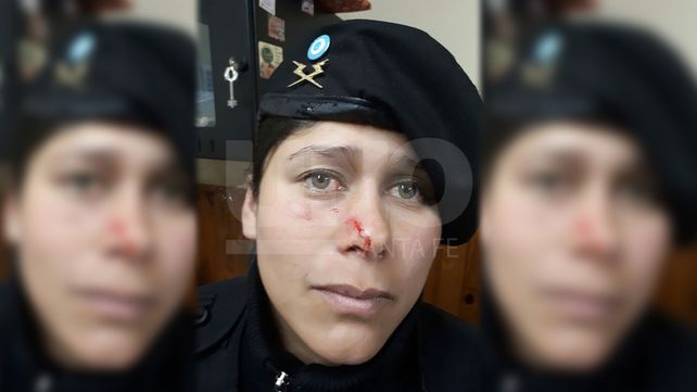 Agredieron en la cara a una suboficial cuando fueron arrestados