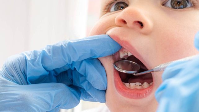 Los odontólogos atienden a niños con caries