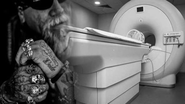 Las resonancias magnéticas a personas tatuadas conllevarían algunos riesgos