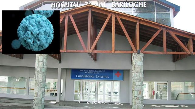 El diagnóstico de Norovirus fue confirmado por el Instituto Malbrán luego se que se detectaran casi 200 casos. Síntomas