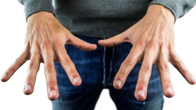 Las uñas Covid, otro síntoma del contagio de coronavirus