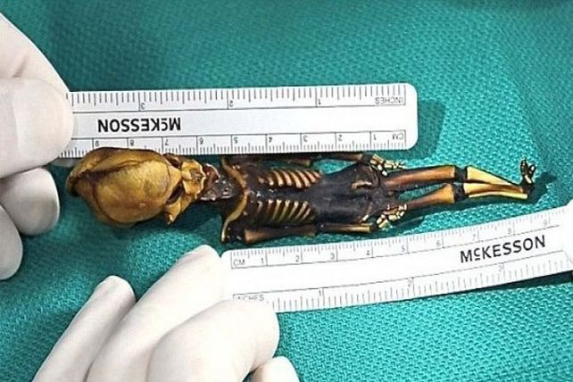 Un extraterrestre que tiene ADN humano