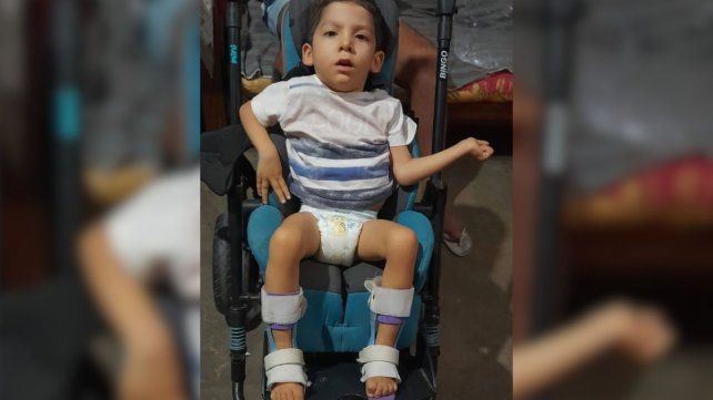 Iniciaron una colecta para un santafesino de 4 años con parálisis cerebral: debe viajar a la India para tratarse Iniciaron una colecta para un santafesino de 4 años con parálisis cerebral: debe viajar a la India para tratarse