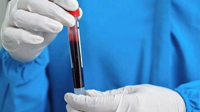 Un test de sangre podría anticipar qué personas tendrán un desarrollo grave o mortal de coronavirus