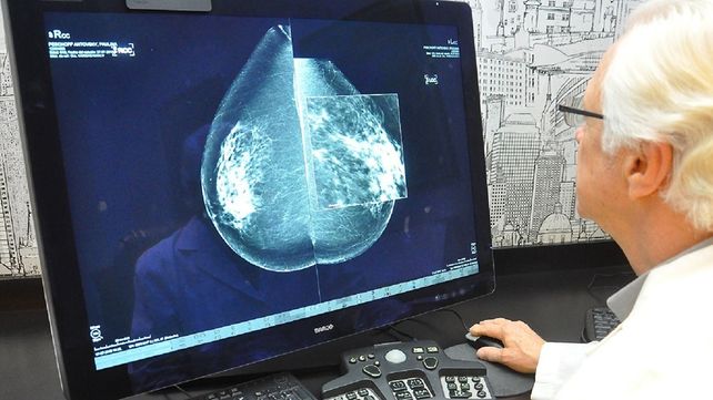 Cáncer de mama: detectados a tiempo el 90% de los tumores pueden curarse