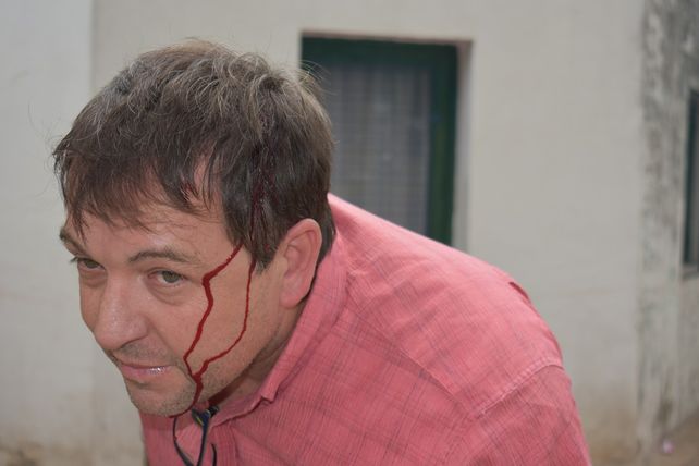 Atacaron con un fierro a un periodista de Santa Elena