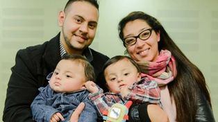 Siameses separados con éxito gracias a una cirugía sin precedentes