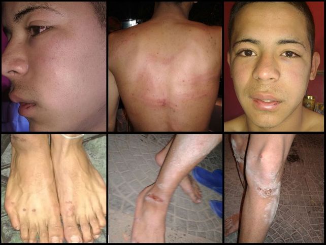 Denuncian torturas cometidos por efectivos de la Prefectura Naval