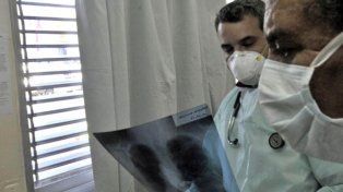 El Streptococcus pyogenes preocupa en Argentina: ya causó 16 fallecimientos