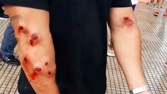 Una muestra de la brutal represión policial desatada en Formosa.