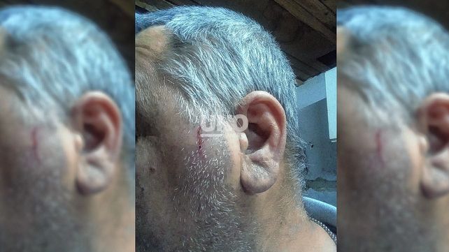 Así quedó el rostro de Carlos