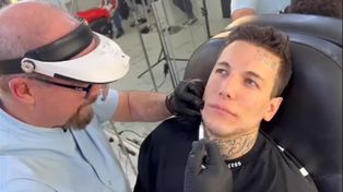 Video: Alex Caniggia quedó irreconocible tras realizarse una intervención estética