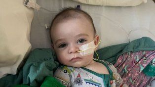 Confirman más de 50 contagios en bebés por un brote de botulismo en EEUU