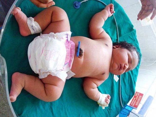 El Bebe Mas Grande Del Mundo Nacio En La India Con 7 Kilos De Peso Y