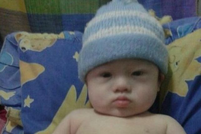 Colecta para ayudar a un bebé con síndrome de down que fue abandonado