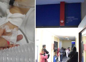 Otro ataque de un pitbull en Santa Fe: cuál es el estado de salud de la beba de 1 año mordida en la cabeza