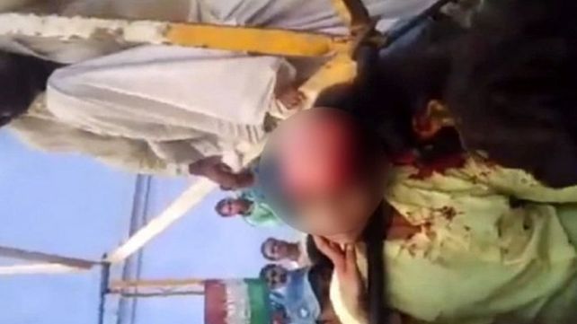 Se sacó una selfie en la vuelta al mundo, se le enredó el pelo y quedó pelada