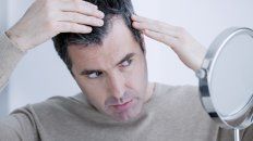 10 pasos de hair recovery para solucionar la perdida de pelo 10 pasos de hair recovery para solucionar la perdida de pelo
