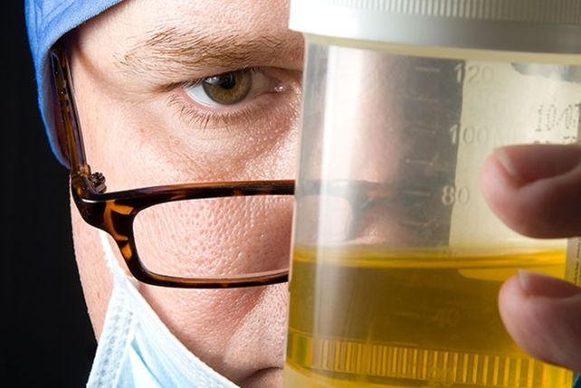 El color de tu orina te informa sobre tu salud