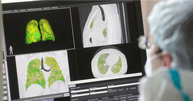 Imágenes: el coronavirus deja peor los pulmones que fumar durante toda una vida