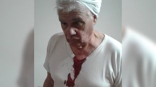 Un expresidente comunal santafesino fue golpeado por violar el aislamiento social