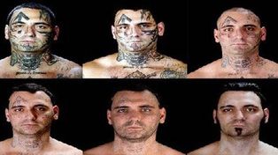 Un racista se someti&oacute; a dolorosas cirug&iacute;as para quitarse los tatuajes
