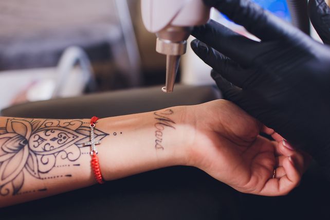 Mucho más que estética: cómo borrar tatuajes, y el ranking de los arrepentidos